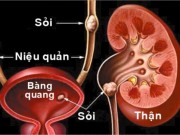 Sức khỏe đời sống - Hai thói quen cực kỳ nguy hiểm có thể làm mất thận