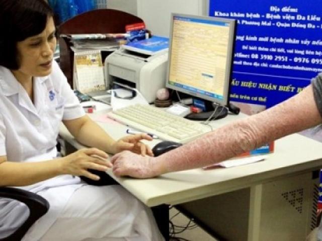Sức khỏe đời sống - Viêm da cơ địa hoành hành mùa lạnh