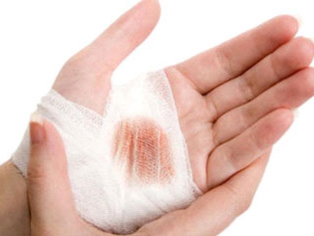 Pháp luật - Sau khi đánh, bị cáo băng bó cho bị hại