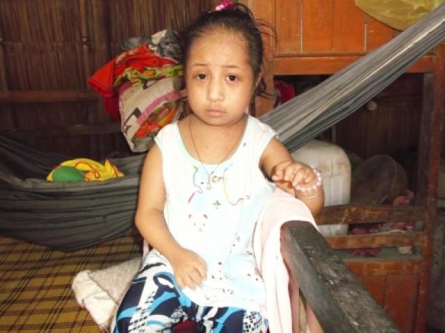 Tin tức trong ngày - "Người nhỏ nhất hành tinh" ở Vĩnh Long giờ ra sao?