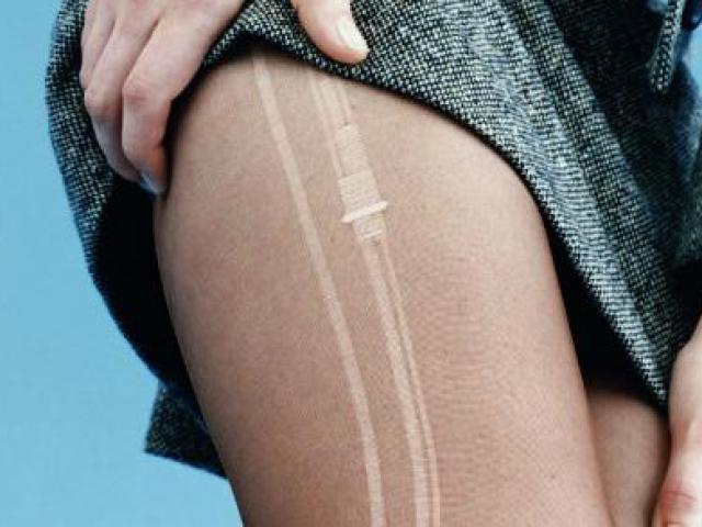 Sức khỏe đời sống - Hiểm họa từ đôi tất quần rất nhiều chị em chưa biết