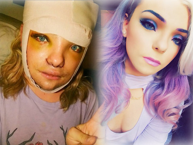 Thẩm mỹ viện - Hot boy chuyển giới chi 750 triệu để "đập mặt xây lại"