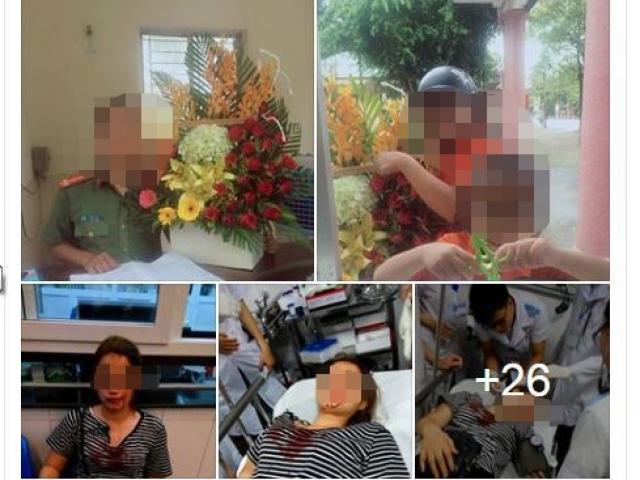 Pháp luật - Sự thật cô gái bị công an đánh vì từ chối tình cảm