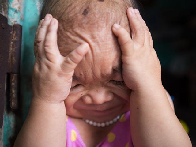 Tin tức trong ngày - Những hình ảnh rớt nước mắt về cô gái nuôi 30 năm không lớn