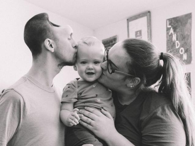 Bạn trẻ - Cuộc sống - Tình yêu người vợ dành cho chồng chỉ có nửa hộp sọ