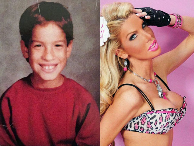 Bạn trẻ - Cuộc sống - Anh chàng chi gần 23 tỷ đồng để phẫu thuật thành búp bê nóng bỏng