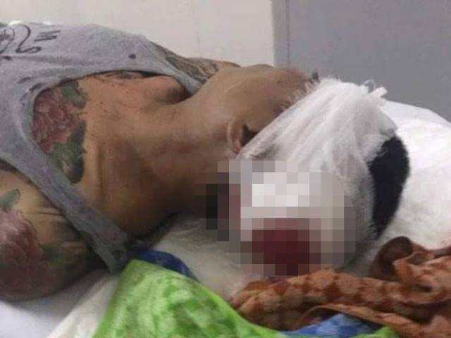 Pháp luật - Kinh hoàng nhóm côn đồ truy sát người dân ở Hà Nội