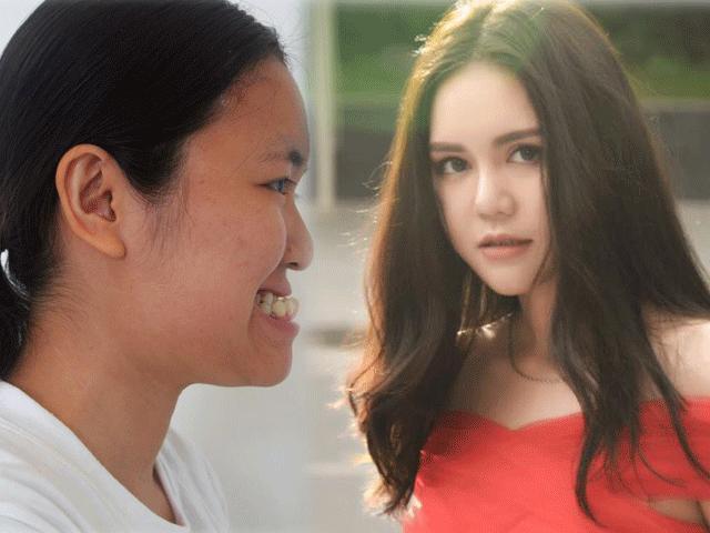 Bạn trẻ - Cuộc sống - Nữ sinh Thương Mại "một bước lên mây" nhờ phẫu thuật thẩm mỹ