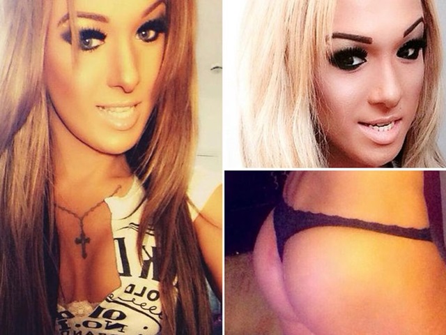 Bí quyết làm đẹp - Bị nổ vòng 3 vẫn chưa sợ, mẫu khỏa thân lại lao đầu vào bơm hông