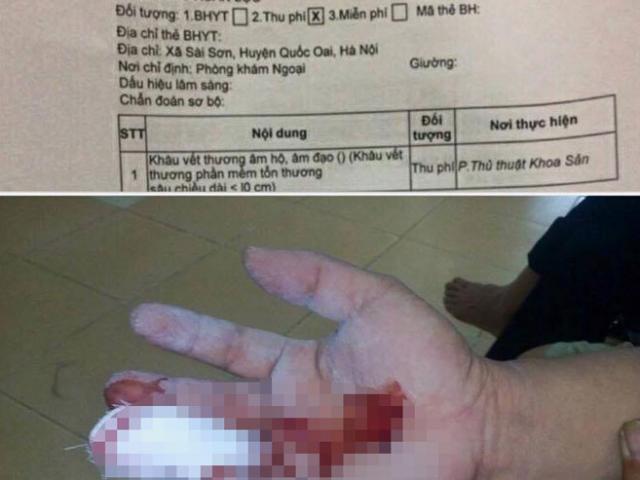 Sức khỏe đời sống - Xôn xao bệnh nhân nam được chỉ định "khâu âm hộ"