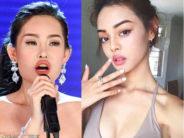 Người mẫu - Hoa hậu - Những đôi môi cá trê của các "siêu phẩm nhan sắc"