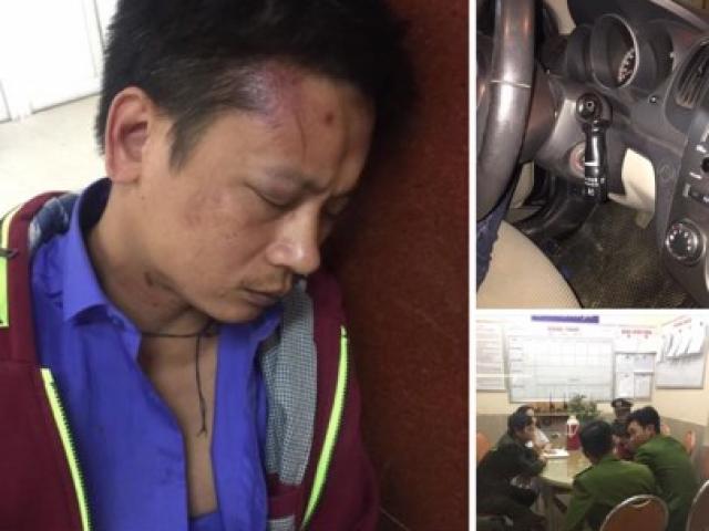 Người nhà tố bảo vệ bệnh viện phụ sản Hà Nội đánh người dã man