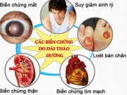 Sức khỏe đời sống - Bác sĩ BV Bạch Mai chỉ ra những sai lầm người đái tháo đường hay mắc phải