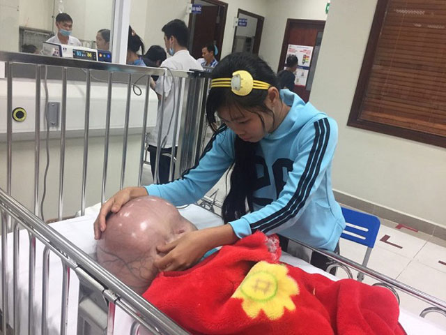 Tin tức trong ngày - Bé trai có đầu căng tròn như quả bóng nước ở Thanh Hóa đã qua đời