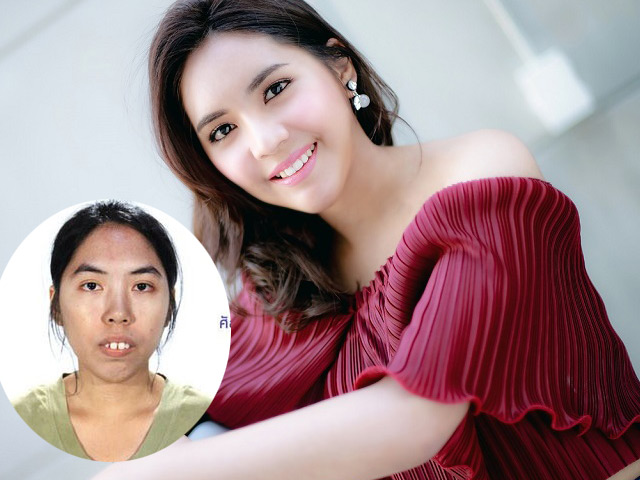 Bí quyết làm đẹp - Vỡ mộng với "mặt gốc" không như là mơ của loạt mỹ nam, mỹ nữ Thái