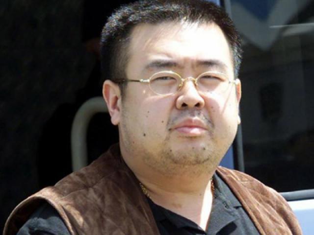 Thế giới - Ông "Kim Jong-nam" mang nhiều thuốc giải độc trong ba lô