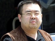 Thế giới - Ông &quot;Kim Jong-nam&quot; mang nhiều thuốc giải độc trong ba lô