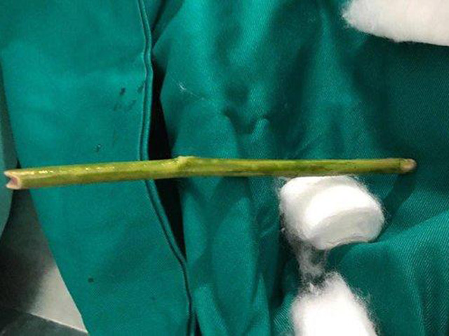 Sức khỏe đời sống - Rùng mình với cách phá thai kinh dị của giới trẻ