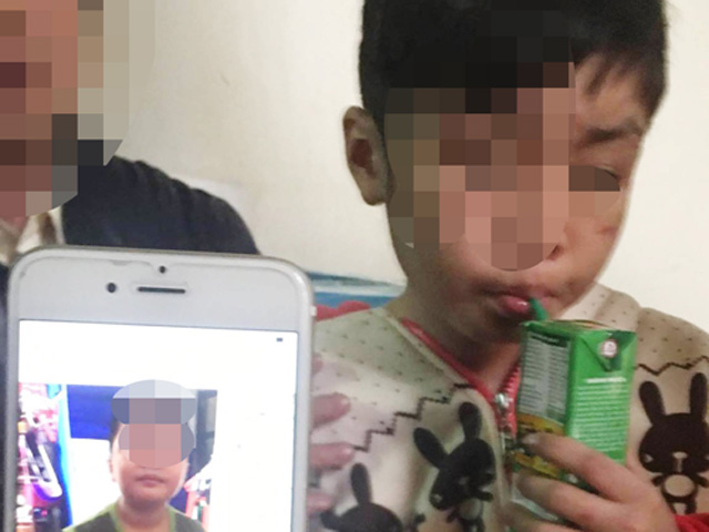 Vụ bé trai 10 tuổi bị bạo hành ở HN: "Đừng hỏi về việc cháu bị bố đánh nữa"