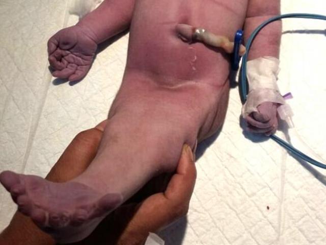 Phi thường - kỳ quặc - Em bé “người cá” chào đời ở Ấn Độ