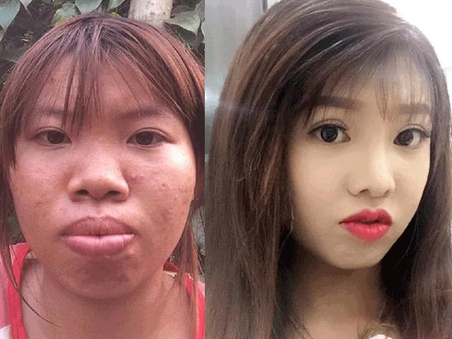 Bí quyết làm đẹp - "Thị Nở tái sinh" và những ca "dậy thì" ngoạn mục nhất 2017