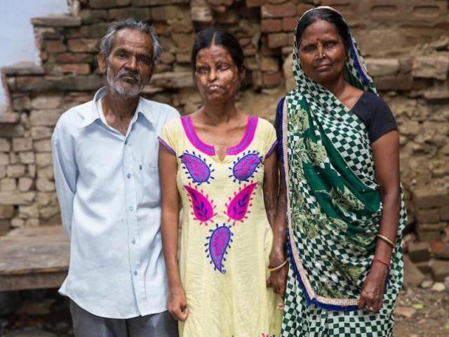 Xót xa 2 mẹ con dù bị tra tấn dã man vẫn phải sống với người chồng “ác quỷ”