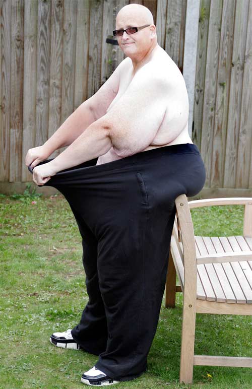 Người đàn ông giảm gần 300kg - 6