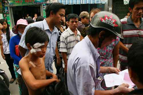 Nổ lớn trong phòng trọ, 5 người bị thương - 4
