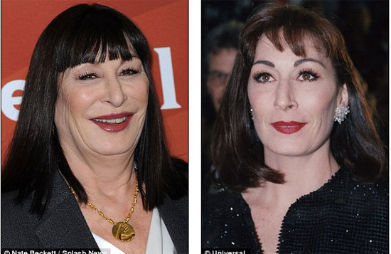 Nữ diễn viên Mỹ biến dạng sau thẩm mỹ - 3