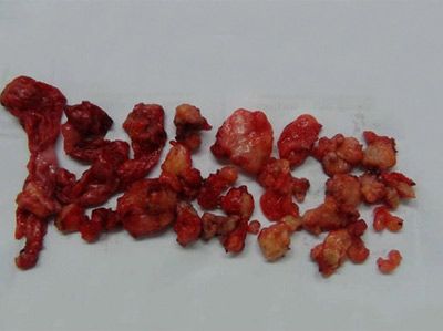 "Trùng tu nhan sắc", thần chết kề bên - 2