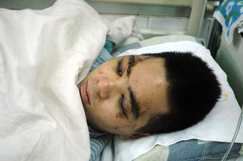 SV thực tập bị đánh: Công an vào cuộc - 1