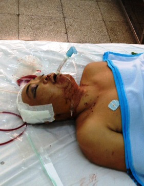 Sập ô văng nhà, 2 người thương vong - 2