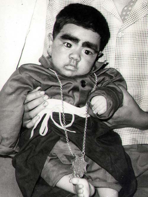 "Người đàn ông lông lá" đã lấy vợ trẻ - 1