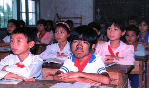 "Người đàn ông lông lá" đã lấy vợ trẻ - 3