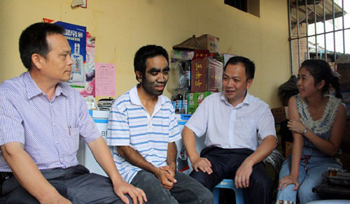 "Người đàn ông lông lá" đã lấy vợ trẻ - 6