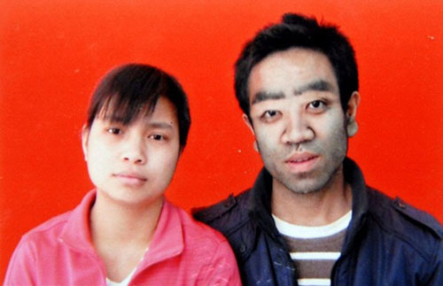 "Người đàn ông lông lá" đã lấy vợ trẻ - 8