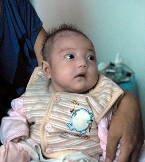 "Người đàn ông lông lá" đã lấy vợ trẻ - 9