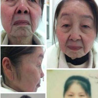 Sức khỏe đời sống - Phụ nữ 28 tuổi thành bà lão 80