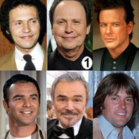 Thẩm mỹ viện - Sao nam biến dạng vì phẫu thuật thẩm mỹ