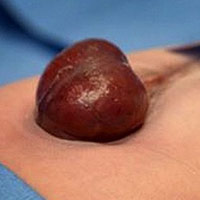 Phi thường - kỳ quặc - Những người có tim nổi ra ngoài lồng ngực