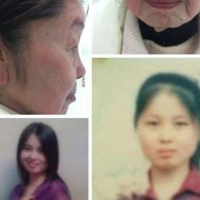 Tin tức trong ngày - TQ: Cô gái trẻ thành bà già 70 sau khi sinh