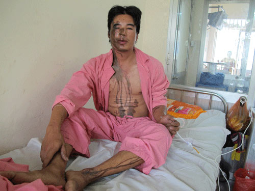 Vợ chồng bị tạt axit mâu thuẫn với ai? - 2