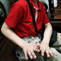 Tin tức trong ngày - Chân dung kẻ chích thuốc lá vào tay trẻ