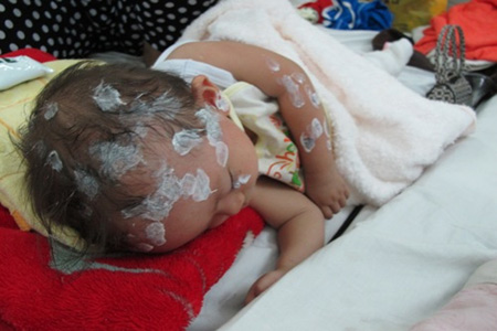 Axít - Sát thủ tàn độc - 4