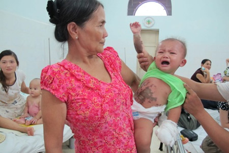 Axít - Sát thủ tàn độc - 3