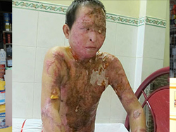 Axít - Sát thủ tàn độc - 5