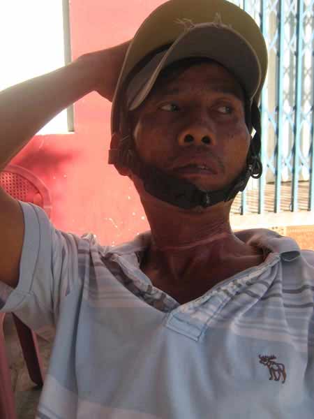 Dây điện thoại cứa ngang cổ người đi đường - 2