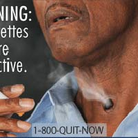 Tin tức trong ngày - 1001 hình ảnh cảnh báo thuốc lá gây sốc