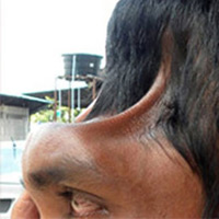 Phi thường - kỳ quặc - Những người có đầu biến dạng đáng sợ