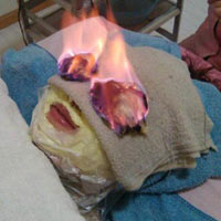 Thẩm mỹ viện - Đốt mắt - xu hướng làm đẹp kinh dị